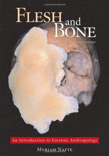 Flesh and Bone