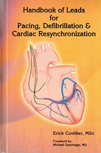 Handbook of Leads for Pacing Defibrillation  Cadiac Resynchronization