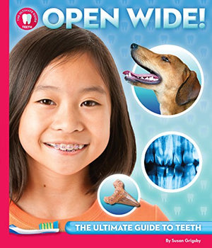Open Wide