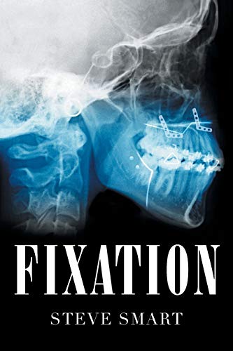 Fixation