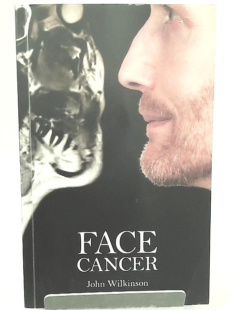 Face Cancer