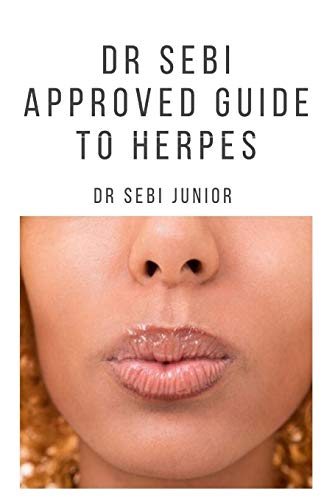 Dr Sebi Approved Guide to Herpes