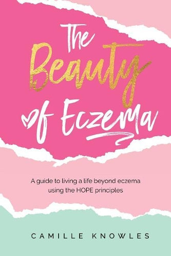 The Beauty of Eczema