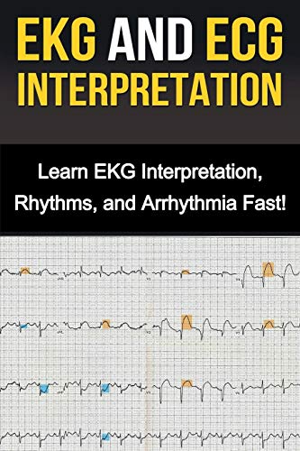 EKG and ECG Interpretation