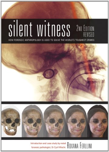 Silent Witness