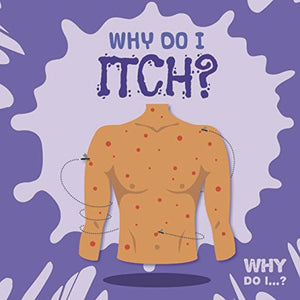 Why Do I Itch? 