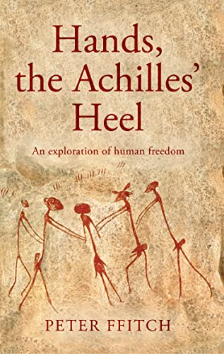 Hands, the Achilles Heel