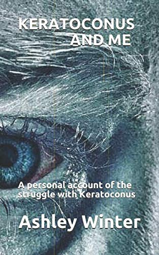 KERATOCONUS AND ME: A personal account of the struggle with Keratoconus