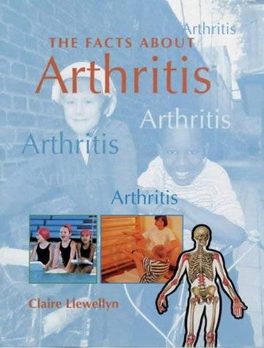 FACTS ABOUT ARTHRITIS