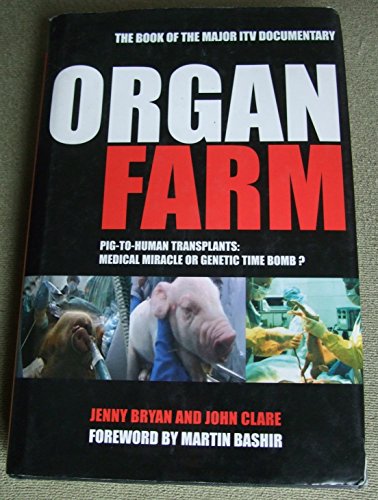 The Organ Farm