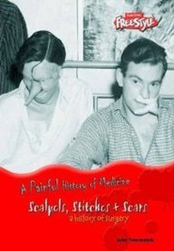Painful History of Medicine Scalpels, Stitches & Scars: A History of Surgery