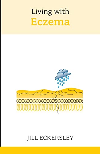 Living with Eczema