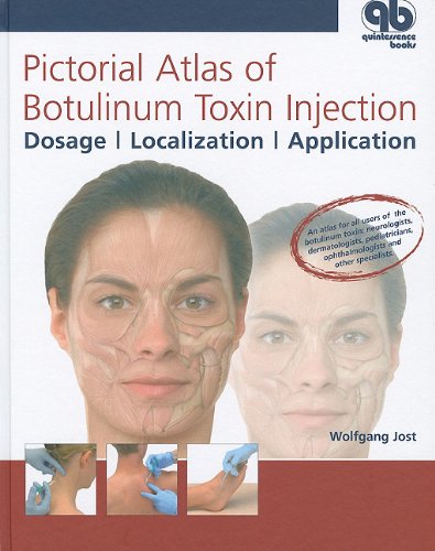 Pictorial Atlas of Botulinum Toxin Injection