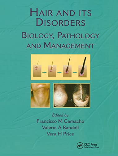 Hair and Its Disorders
