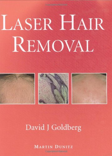 Laser Hair Removal