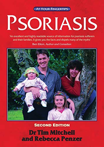 Psoriasis 2e