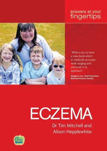 Eczema