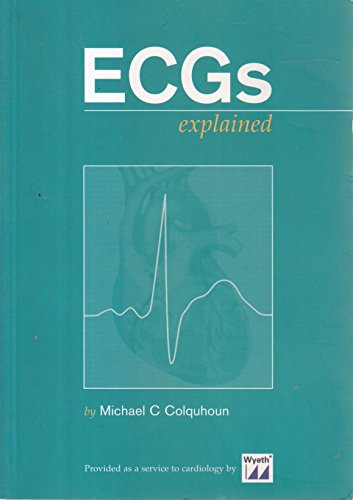 ECGs Explained