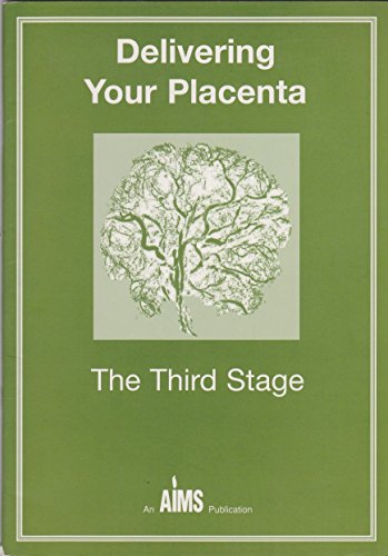 Delivering Your Placenta