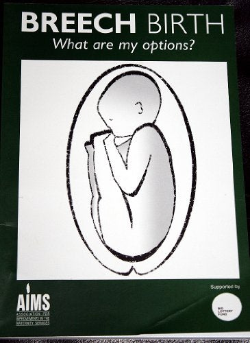 Breech Birth