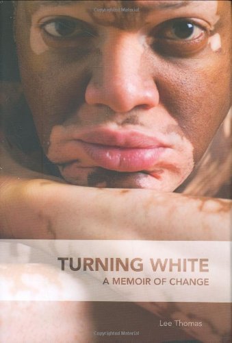 Turning White