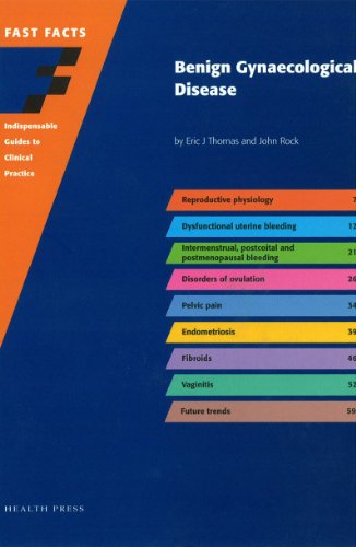 Fast Facts: Benign Gynaecological Disease