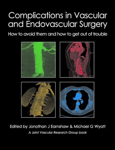 Complications in Vascular and Endovascular Surgery