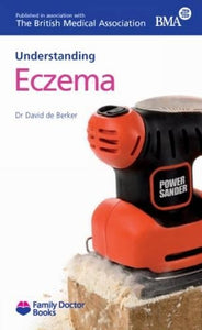 Understanding Eczema 