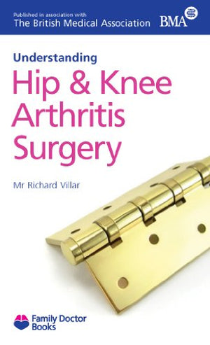 Understanding Hip & Knee Arthritis Surgery