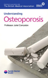 Understanding Osteoporosis 