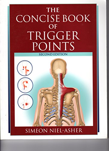 Concise Book of Trigger Points
