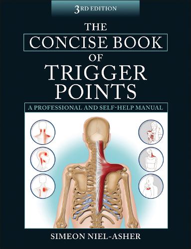 The Concise Book of Trigger Points