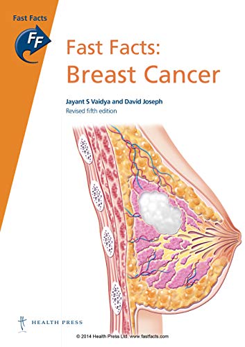 Fast Facts: Breast Cancer