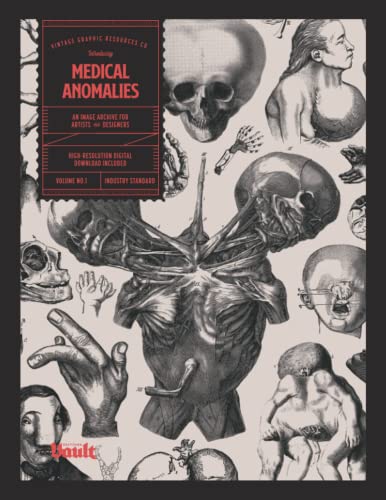Medical Anomalies
