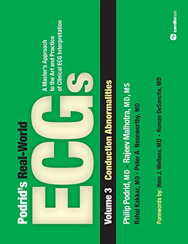 Podrid's Real-World ECGs