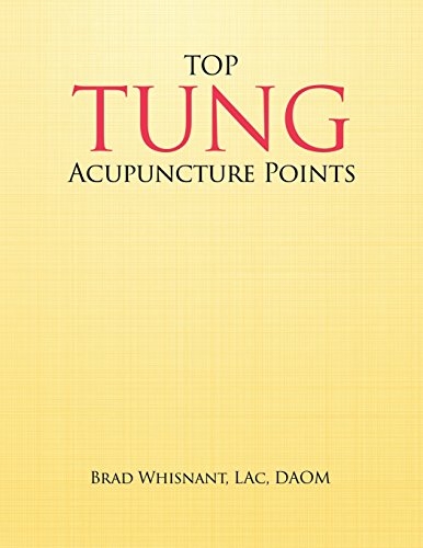 Top Tung Acupuncture Points