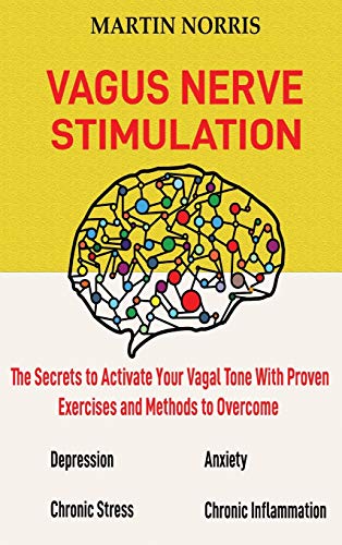 Vagus Nerve Stimulation