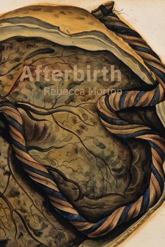 Afterbirth