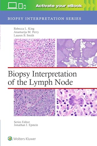 Biopsy Interpretation of the Lymph Node: Print + eBook with Multimedia