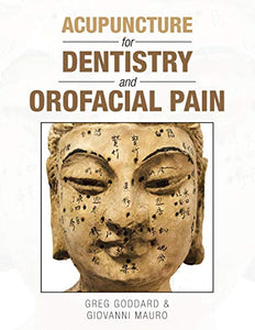 Acupuncture for Dentistry and Orofacial Pain 