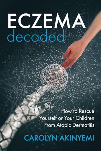 Eczema Decoded