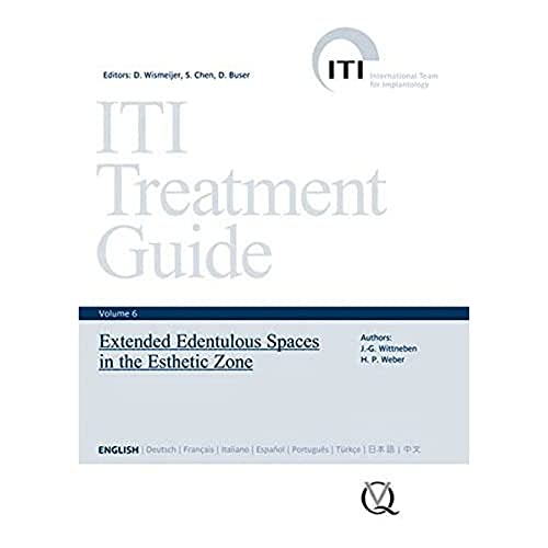 ITI Treatment Guide