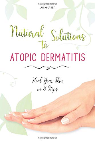 Natural Solutions to Atopic Dermatitis: Heal Your Skin in 8 Steps