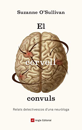 El cervell convuls: Relats detectivescos d'una neuròloga
