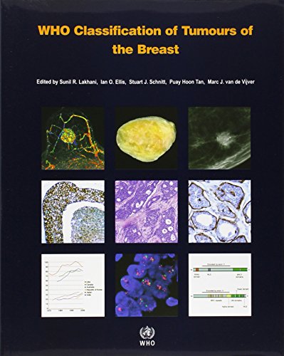 WHO Classification of Tumours of the Breast