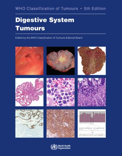 WHO Classification of Tumours. Digestive System Tumours