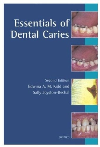 Essentials of Dental Caries