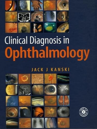 Clinical Diagnosis in Ophthalmology