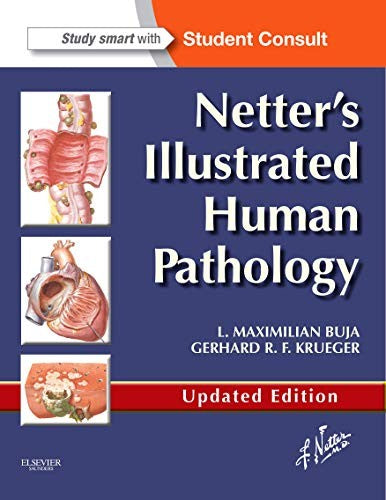 Netter's Illustrated Human Pathology Updated Edition