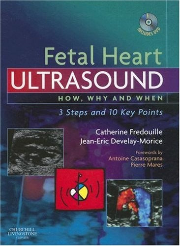 Fetal Heart Ultrasound cover